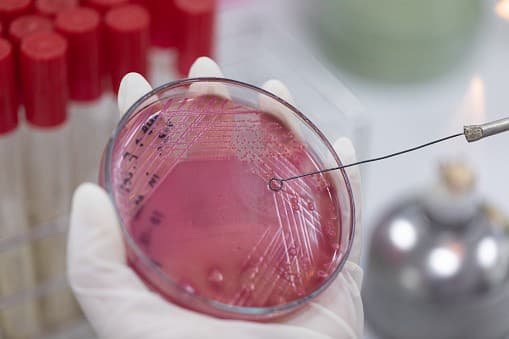 Veda sa MÝLILA: Kanadskí