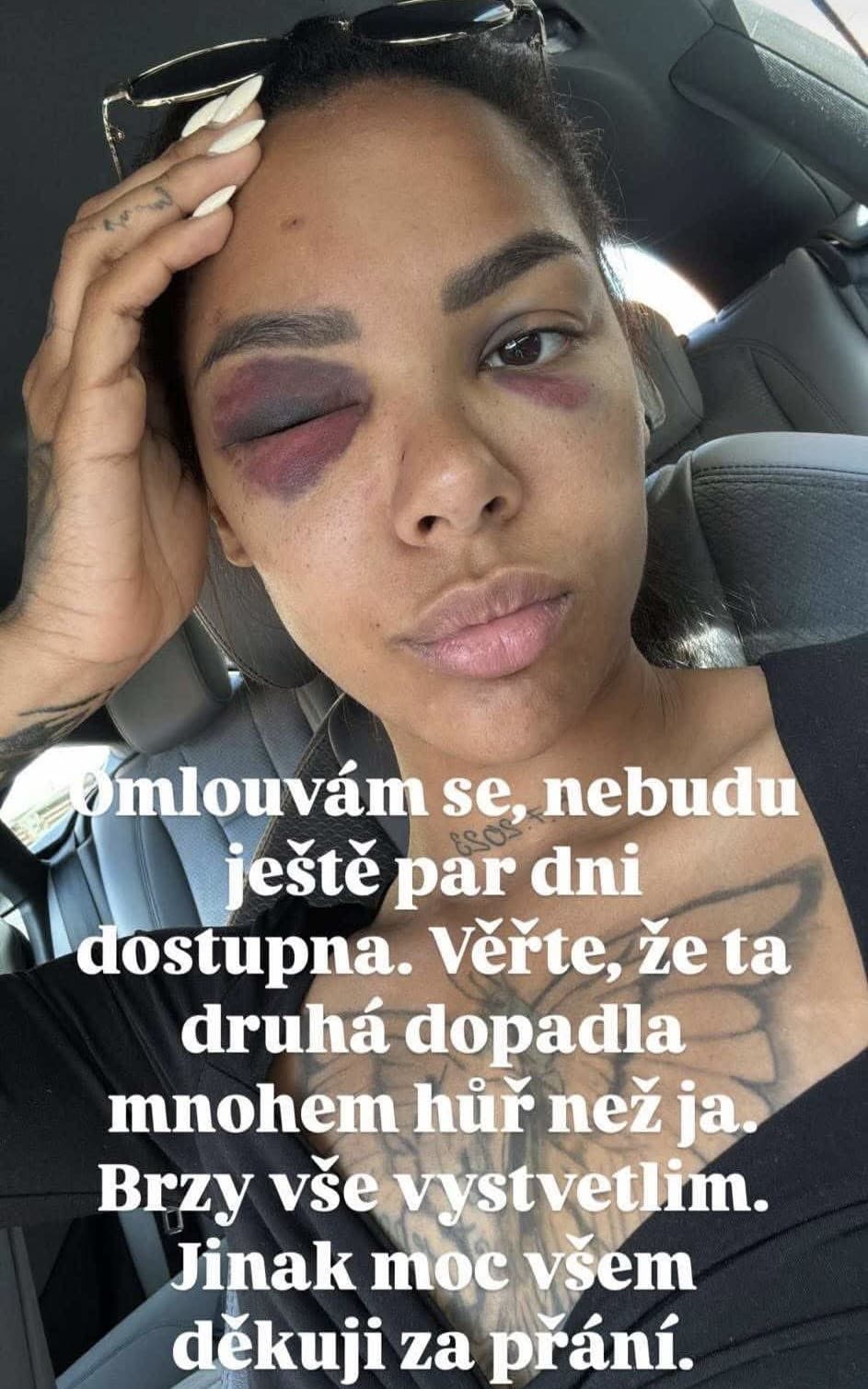 PREBOHA! Známa Češka totálne