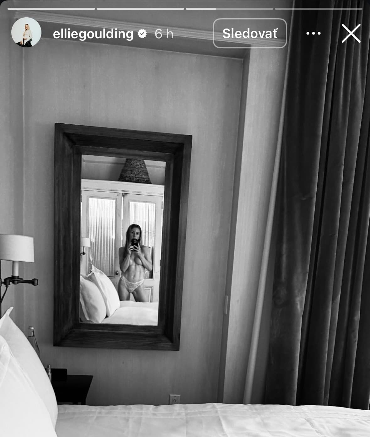 Slávna speváčka nedala predstavivosti