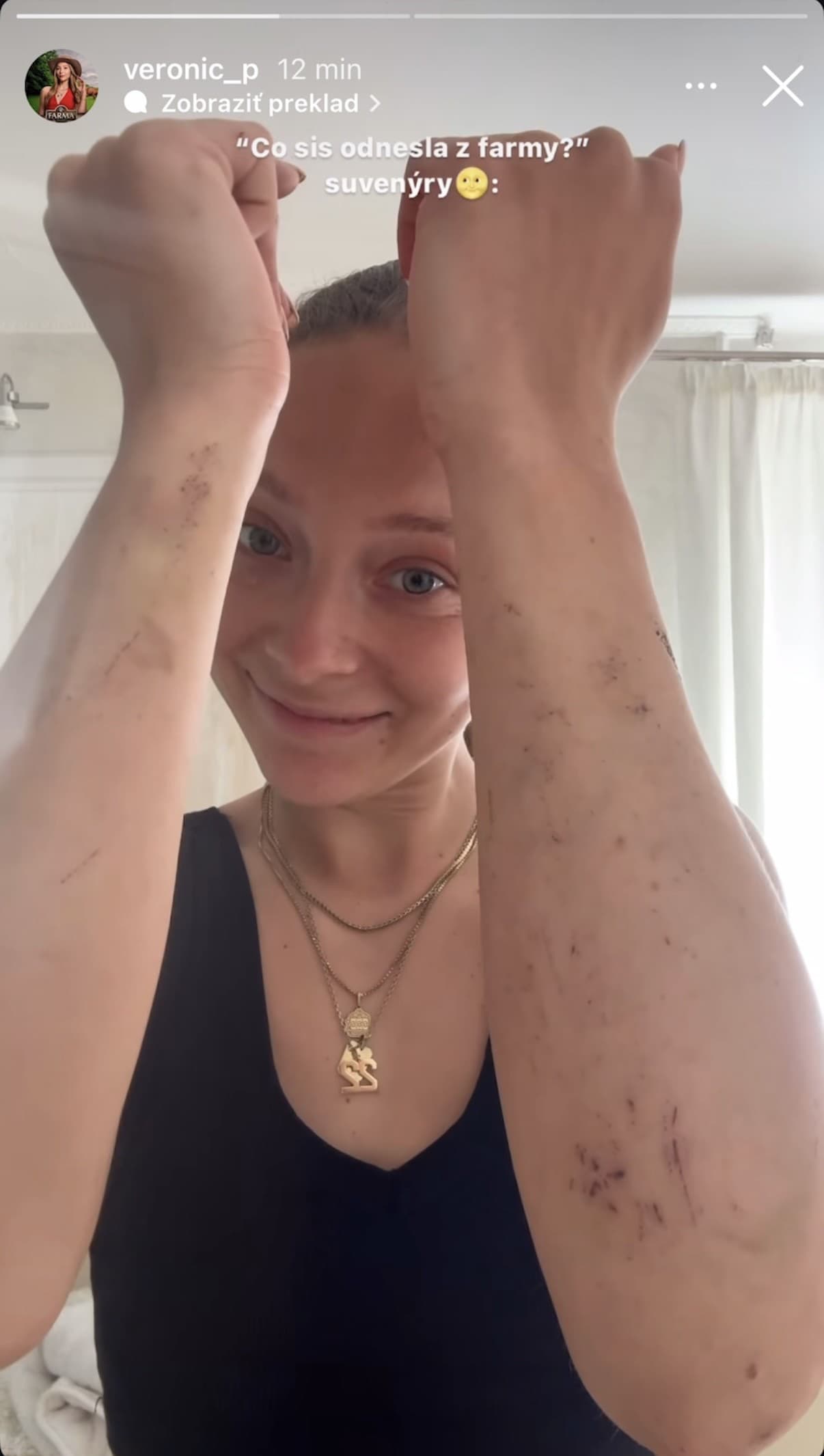 VÍŤAZKA Farmy za výhru