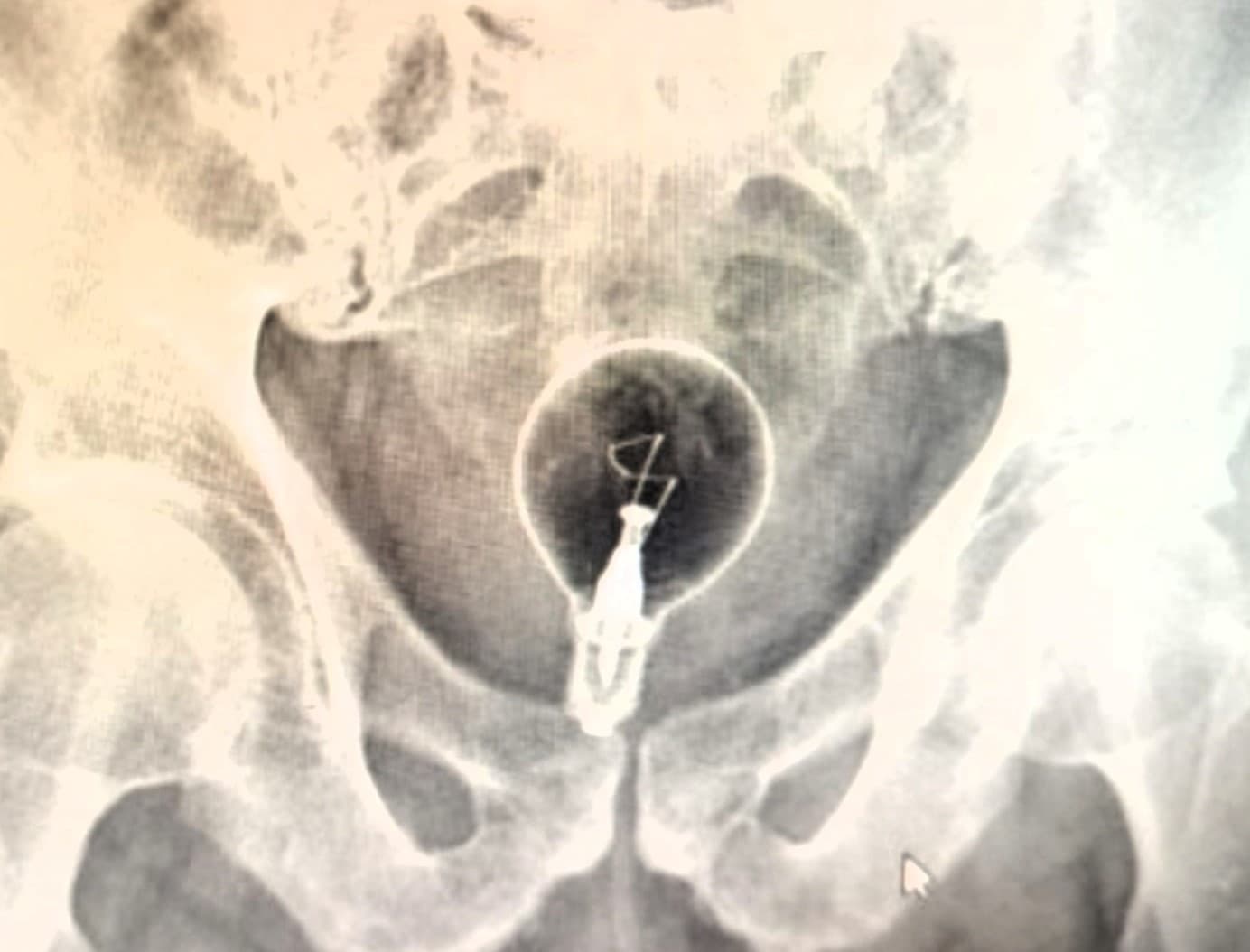 BIZARNÝ prípad v nemocnici: