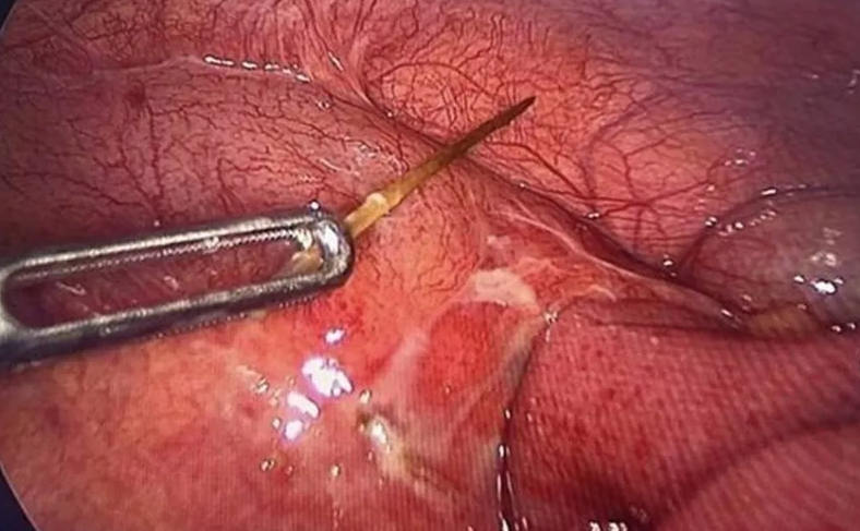 Zlozvyk ho takmer zabil: