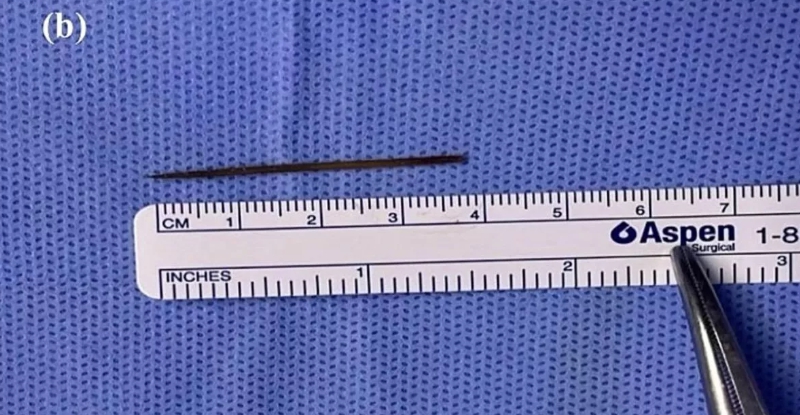 Zlozvyk ho takmer zabil: