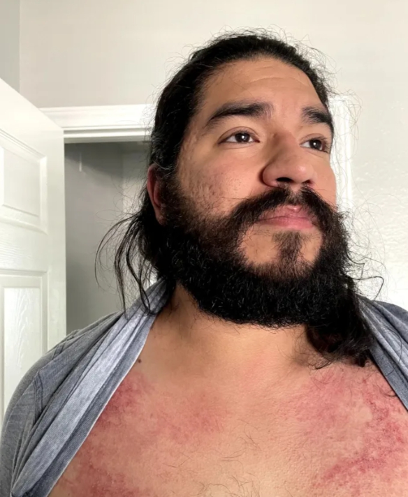 Texaská rodina prišla o dom aj zdravie.