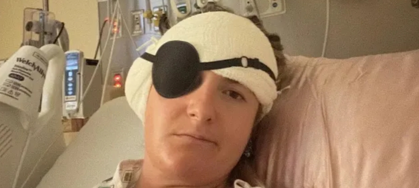 Mladá žena stratila sluch počas letu, lekári odhalili nádor veľký ako avokádo.