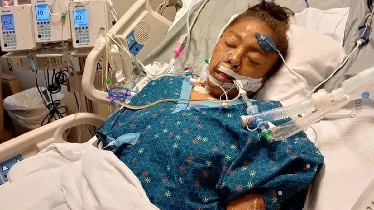 Žena prišla o všetky končatiny.