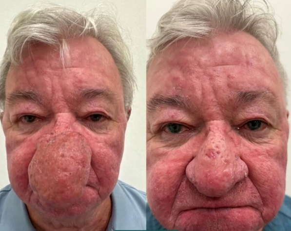 Tvár mu zdeformovalo zriedkavé ochorenie.