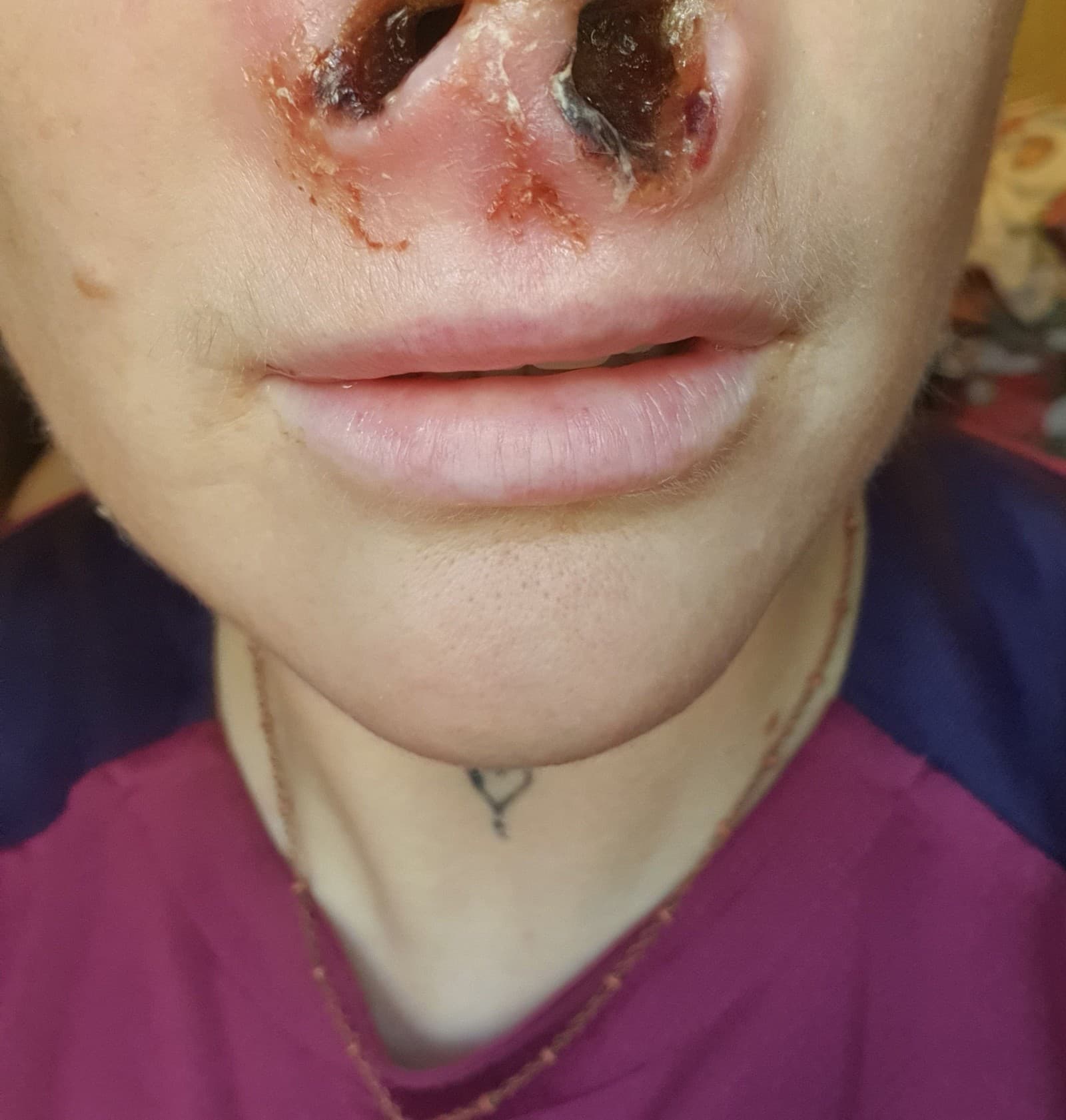 Z vysnívaných zubov NOČNÁ