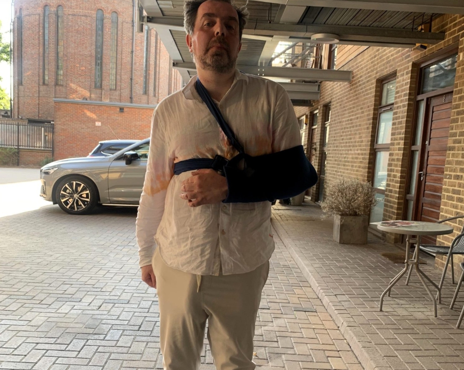 Muž s najväčším penisom na svete skončil v nemocnici.