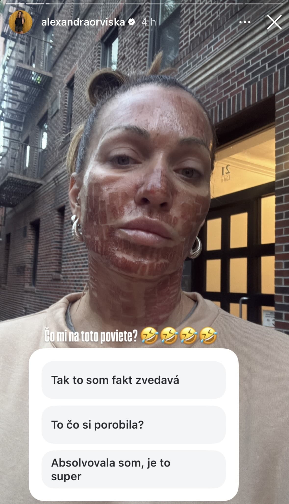 Orviská DESÍ vzhľadom: Vyzerá