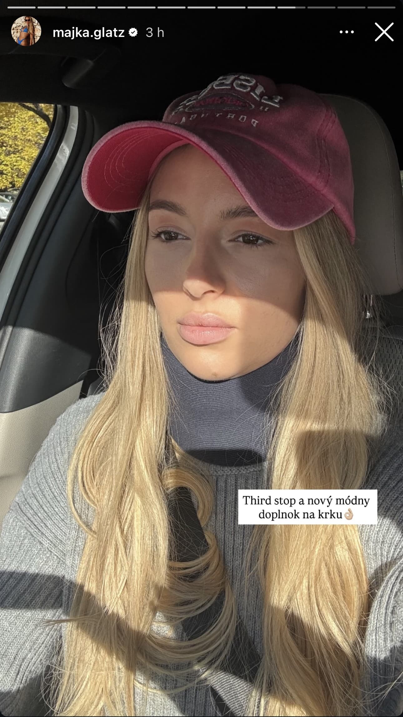 Majka Glatzová po fyzickom útoku susedky.