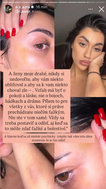 Drsný ROZCHOD Azry z