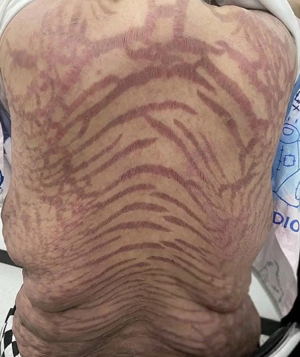 Žena sa po kréme z internetu zmenila na hada!