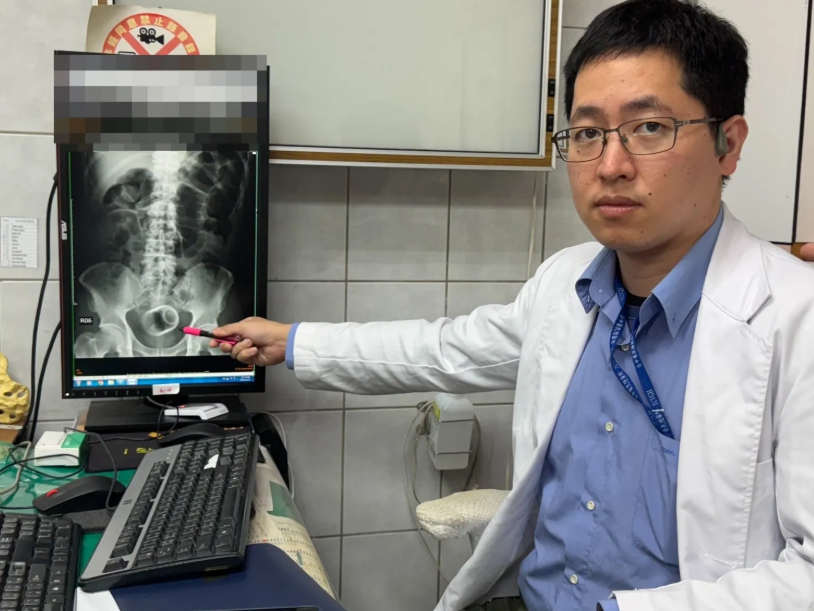 V mužovom konečníku našli keramický hrnček!