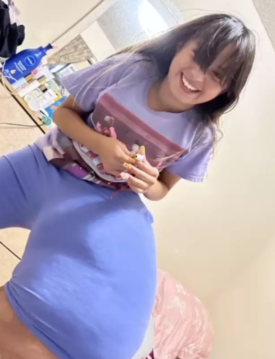 Amputácia zachránila 14-ročnej Jasmine život