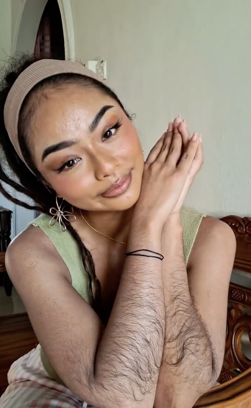 Kvôli prílišnému ochlpeniu ju