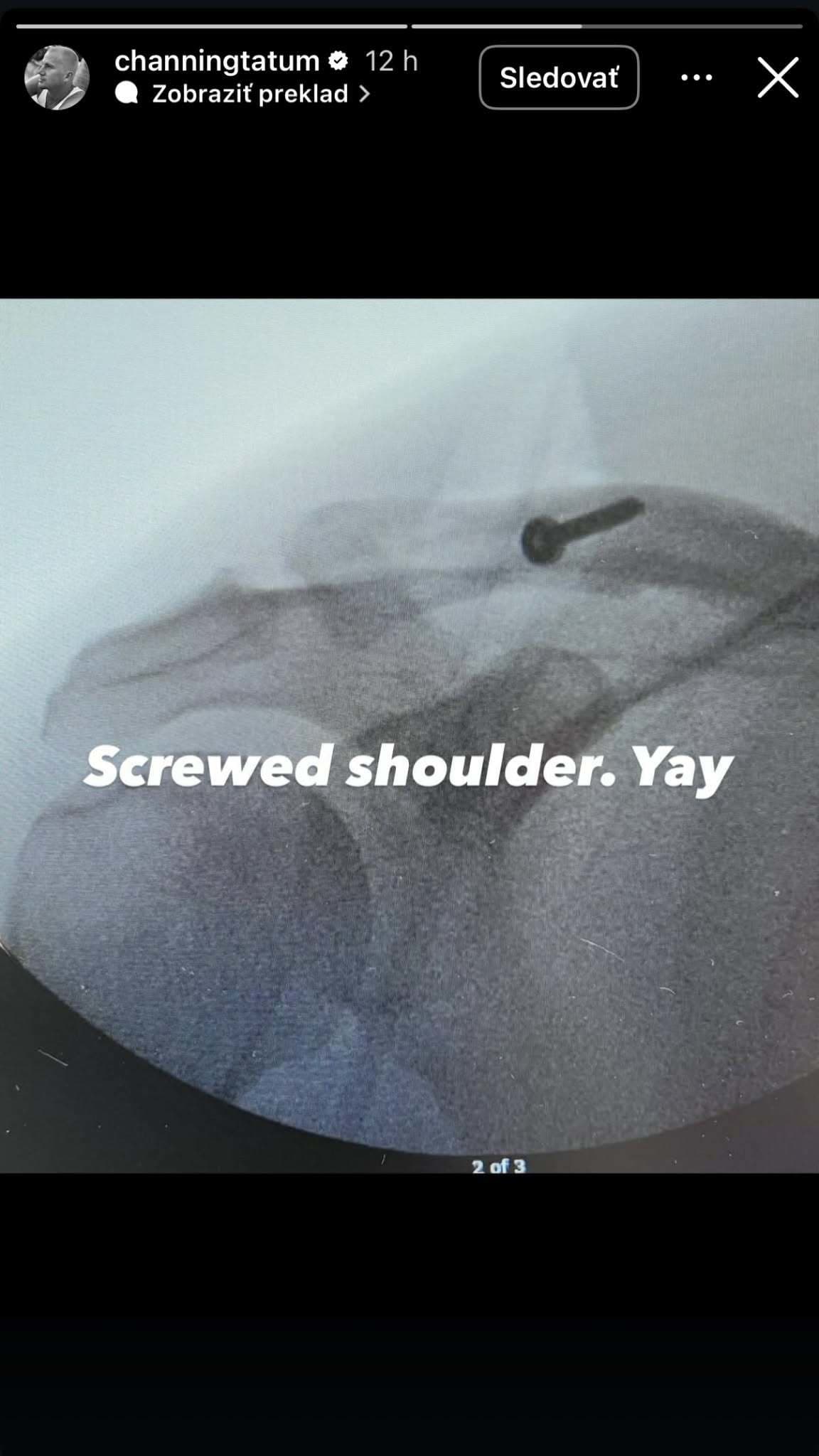 STRACH o hviezdneho herca: