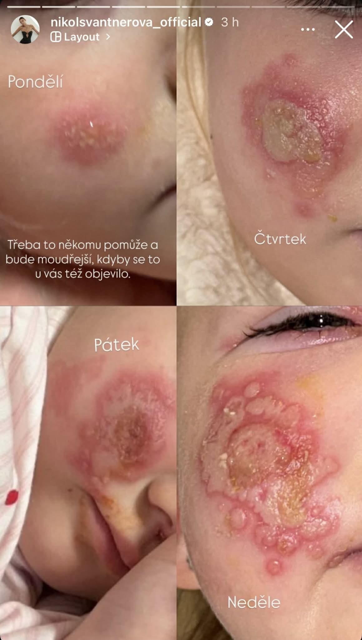 STRACH česko-slovenskej krásky: Tvár