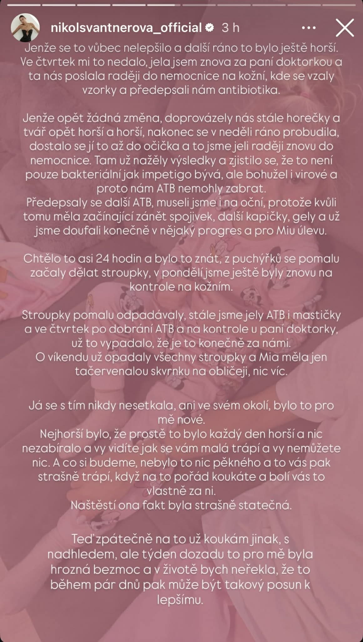 STRACH česko-slovenskej krásky: Tvár