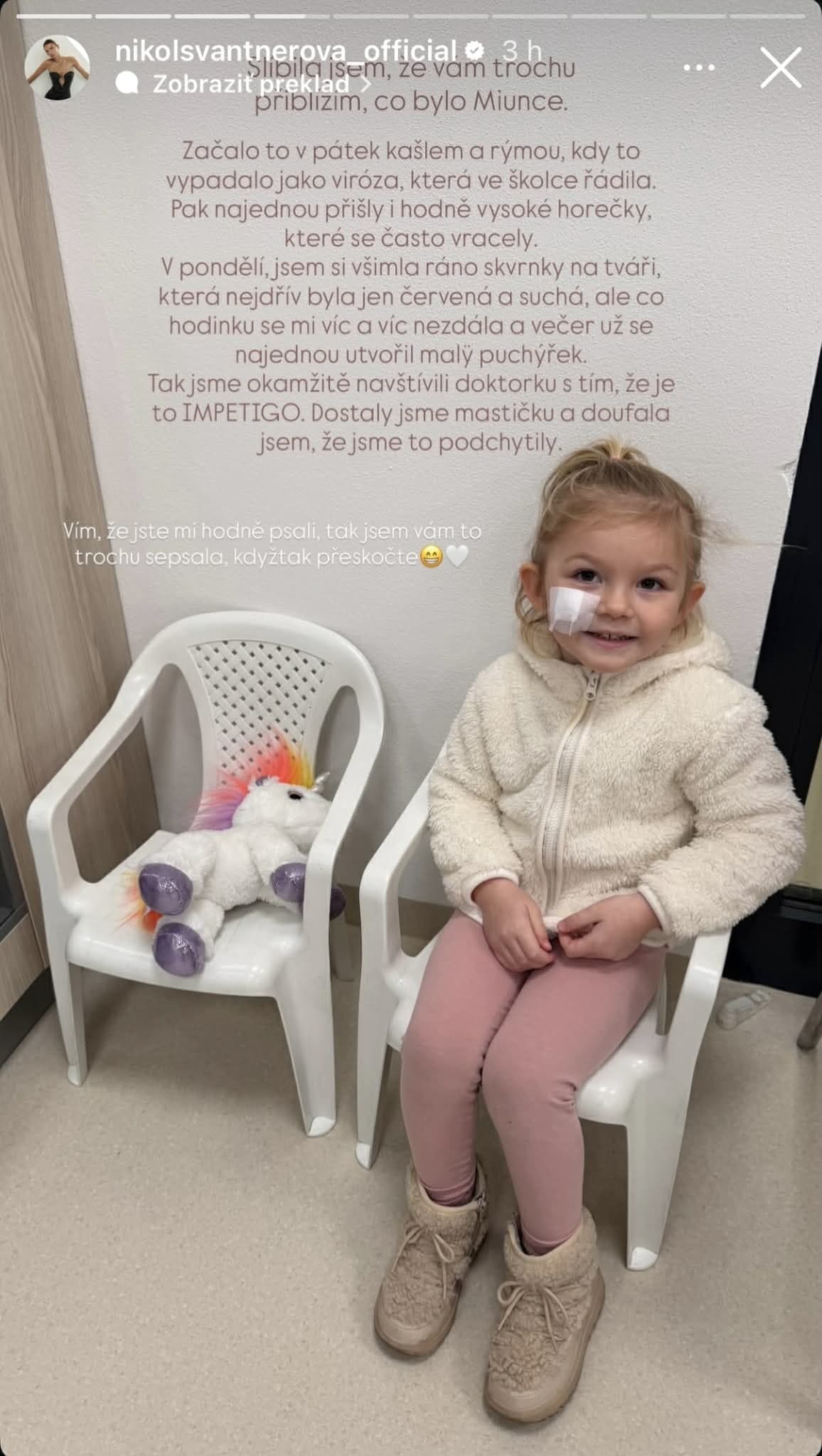 STRACH česko-slovenskej krásky: Tvár