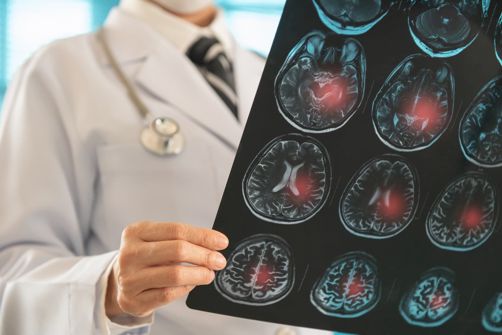 Vaša pamäť KLAME: Vedci