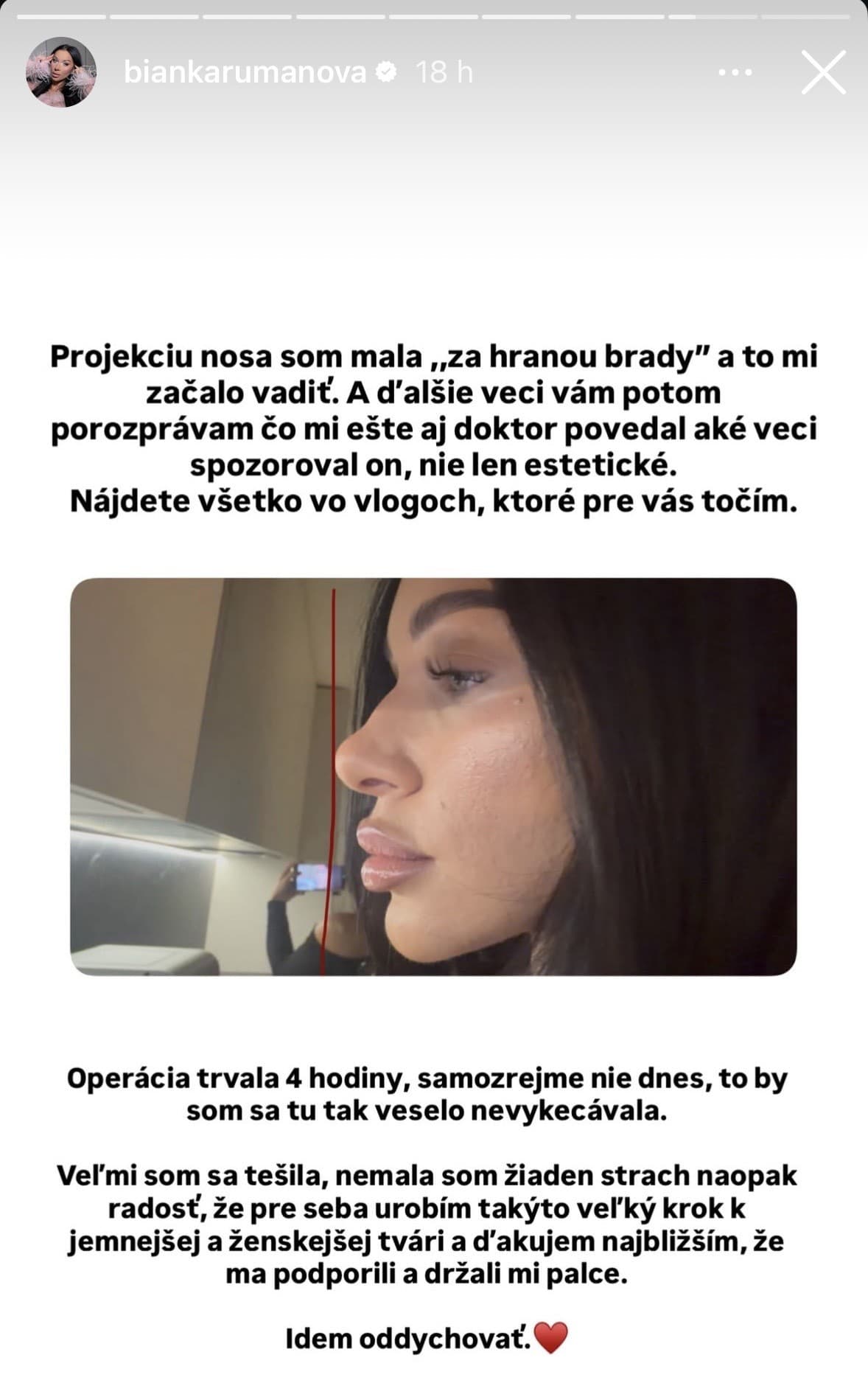 Bianka Rumanová sa nechala