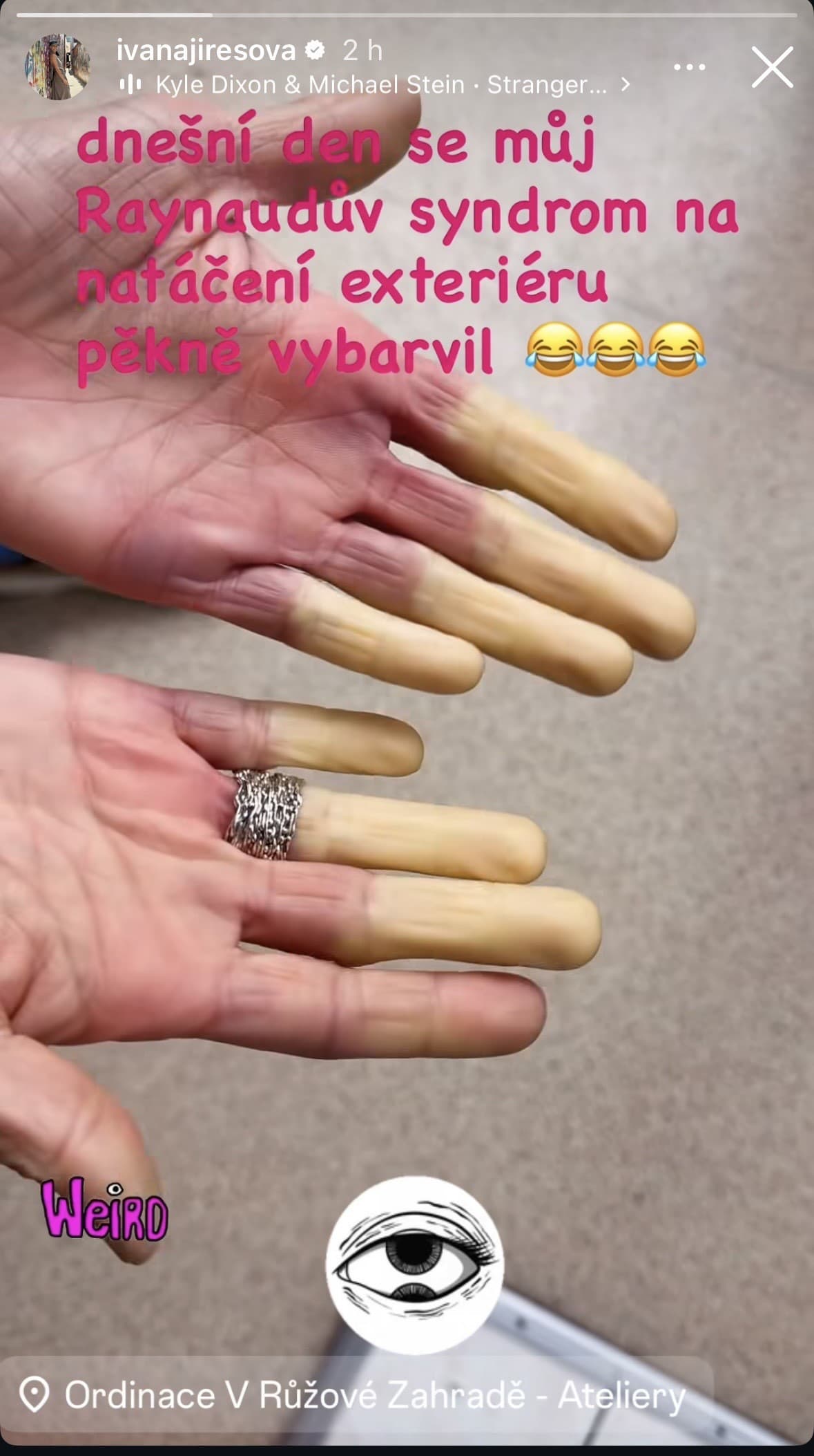 DESIVÁ porucha českej herečky: