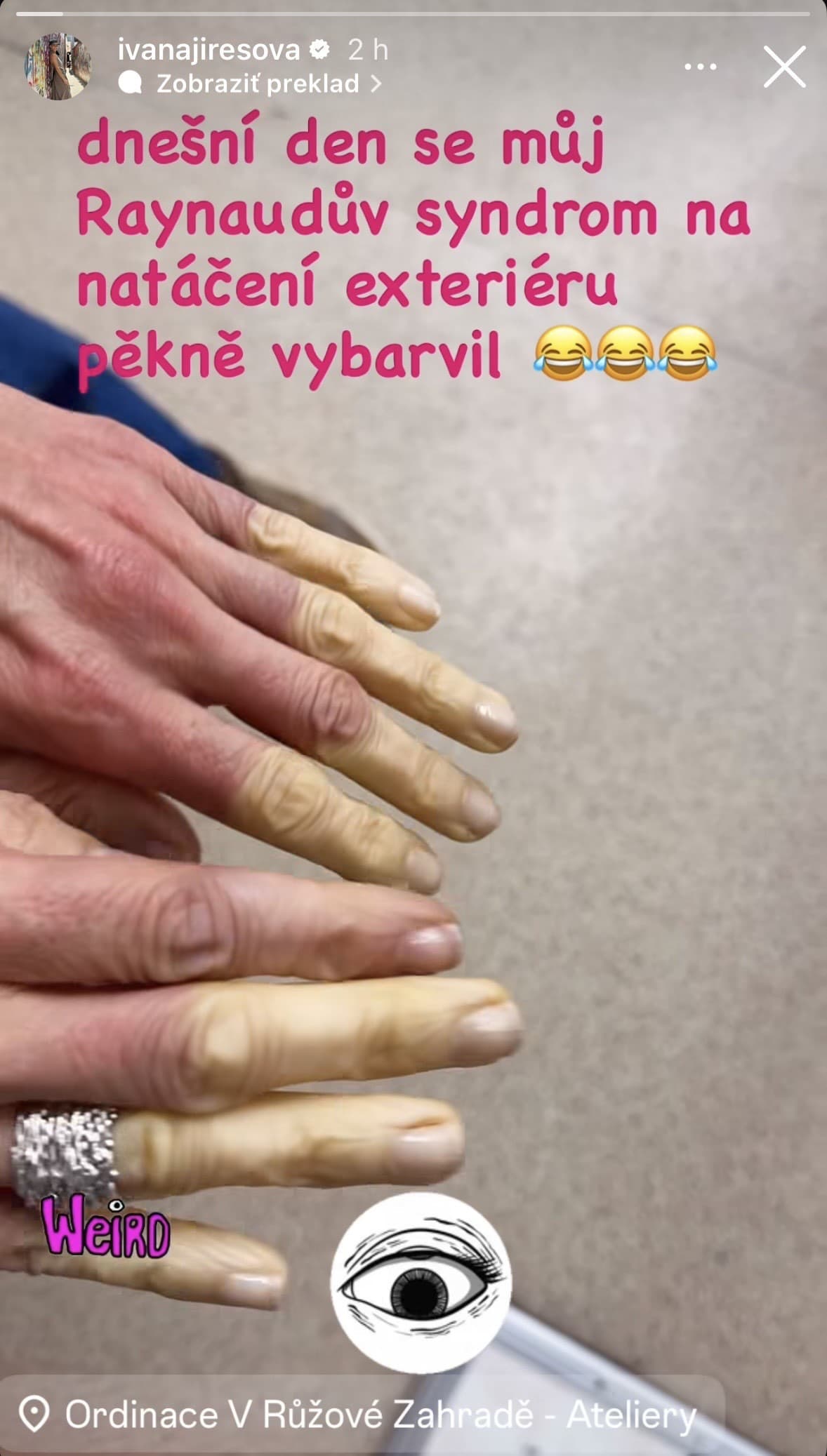 DESIVÁ porucha českej herečky: