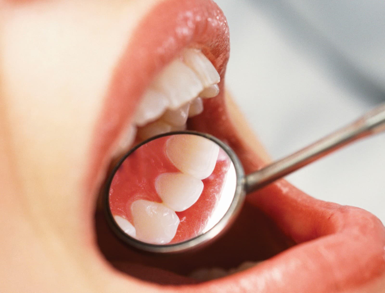 Zdravý úsmev, zdravé telo: