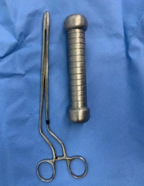 Muž mal v tele dvojkilogramovú činku.