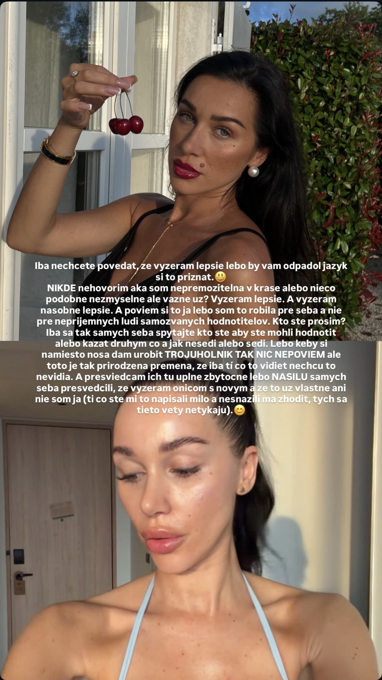 Bianka Rumanová s novým nosom. 