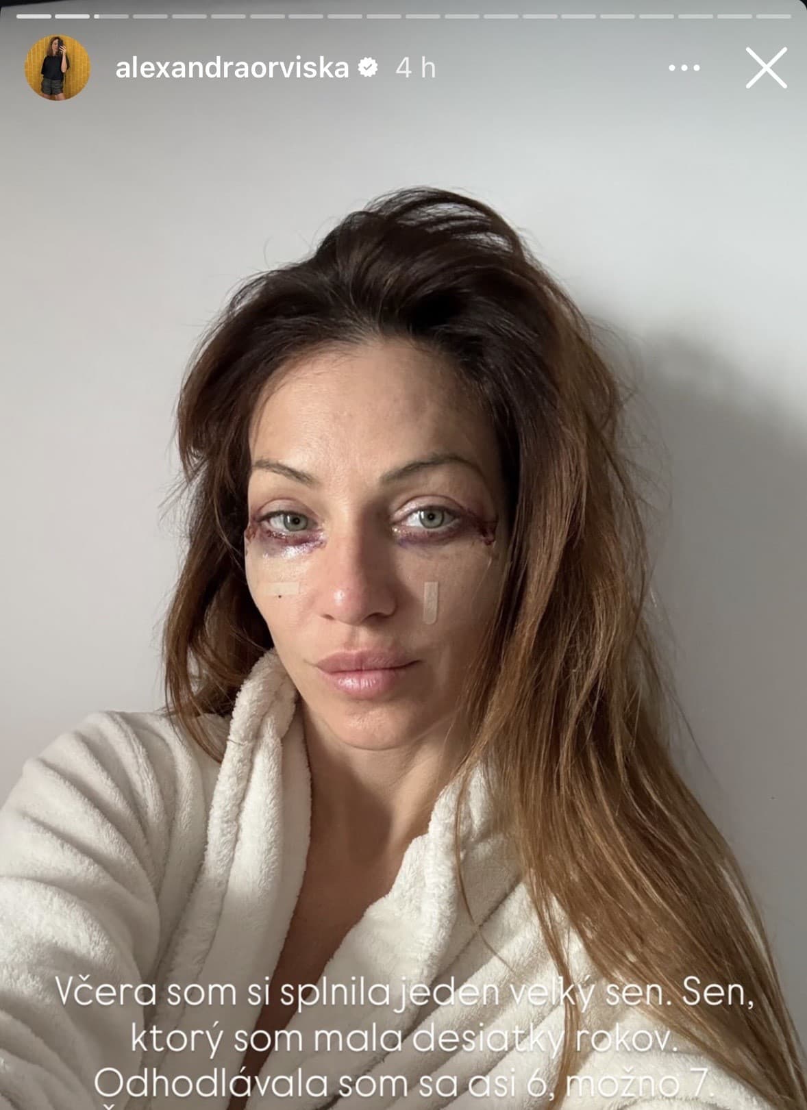 Orviskej FOTO by vystrašilo