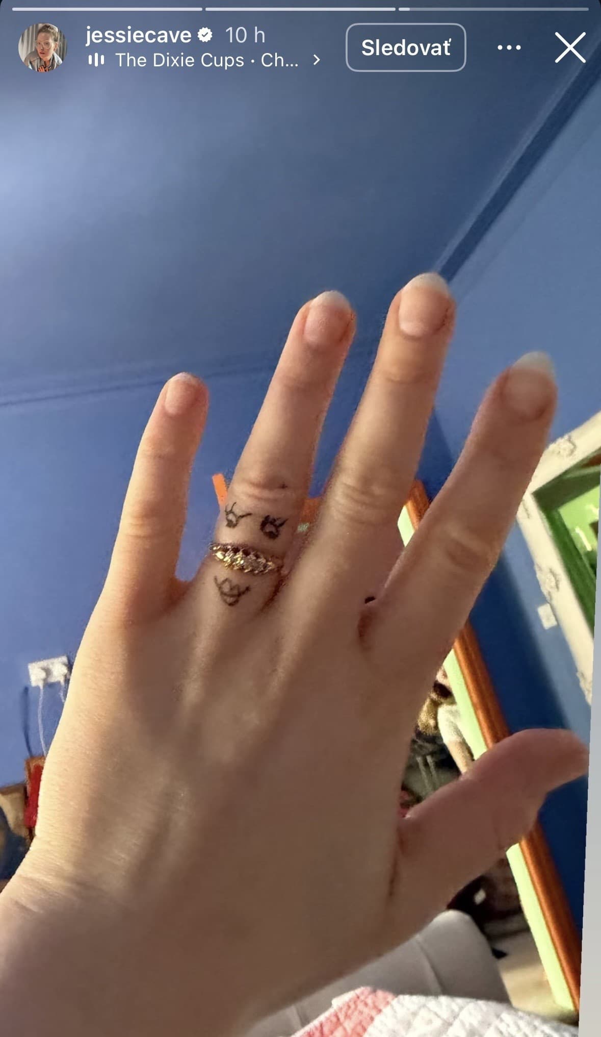 Hviezda Harryho Pottera sa