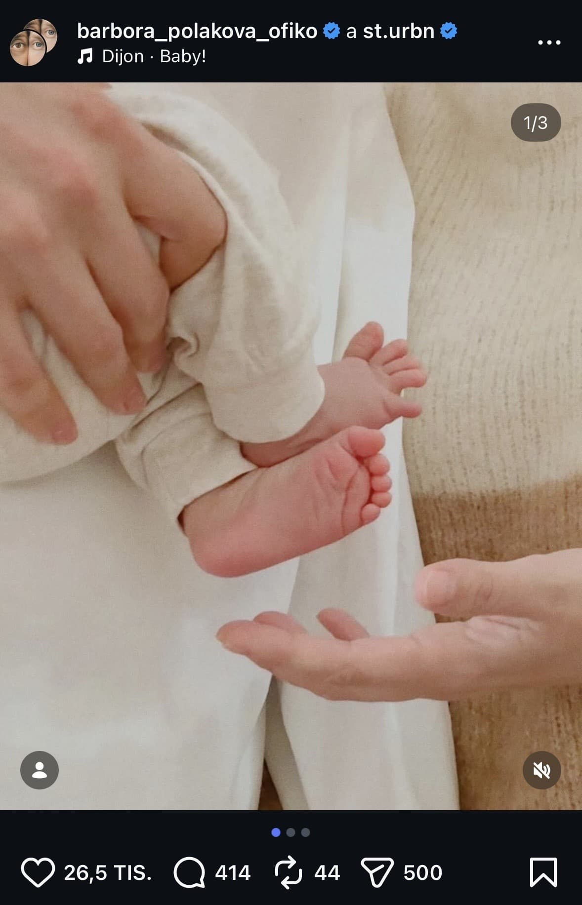 Česká herečka (42) porodila