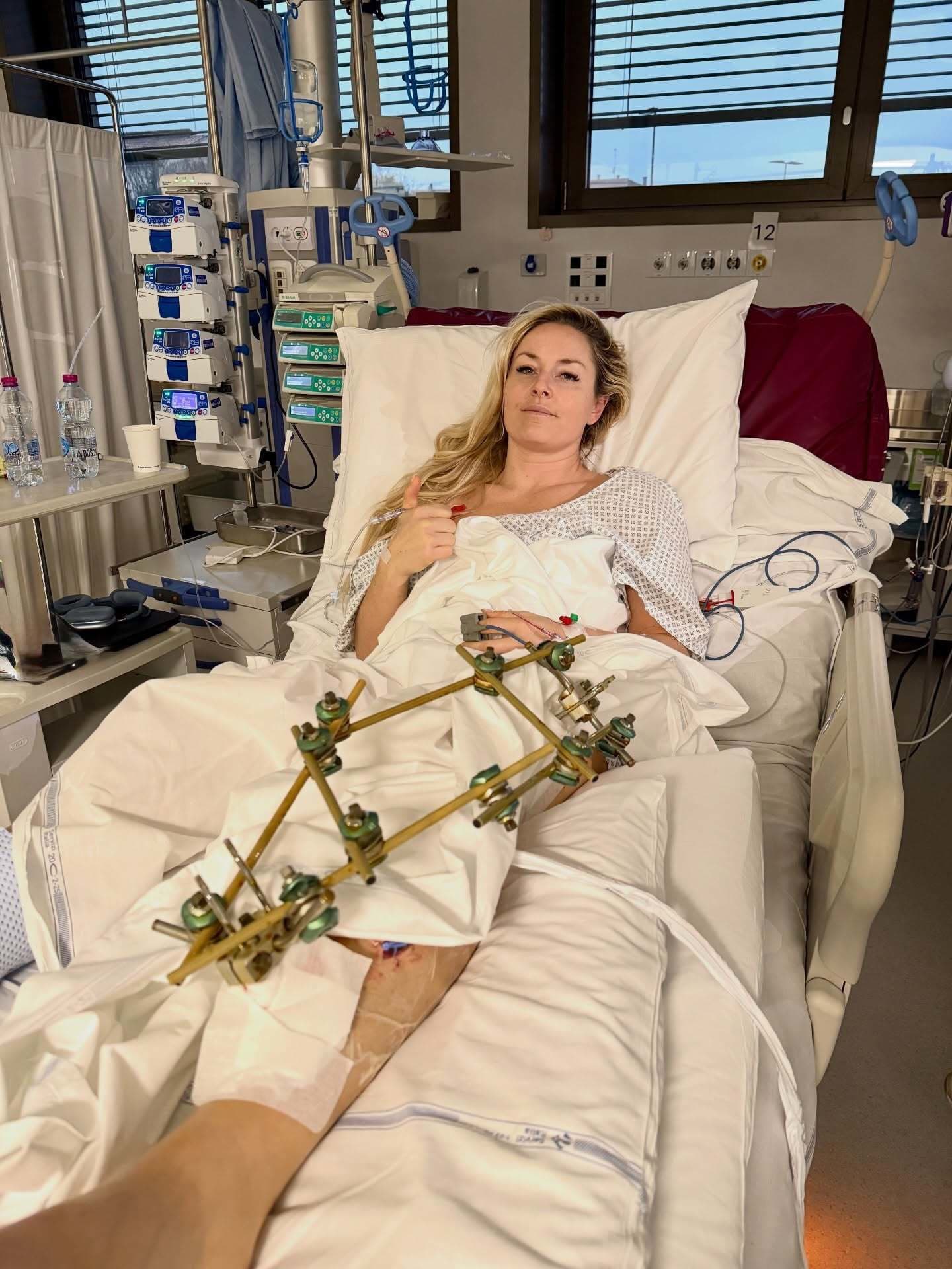Lindsey Vonnová ani päť mesiacov po nehode nie je v poriadku. Členok je stále zlomený a zle sa jej chodí!