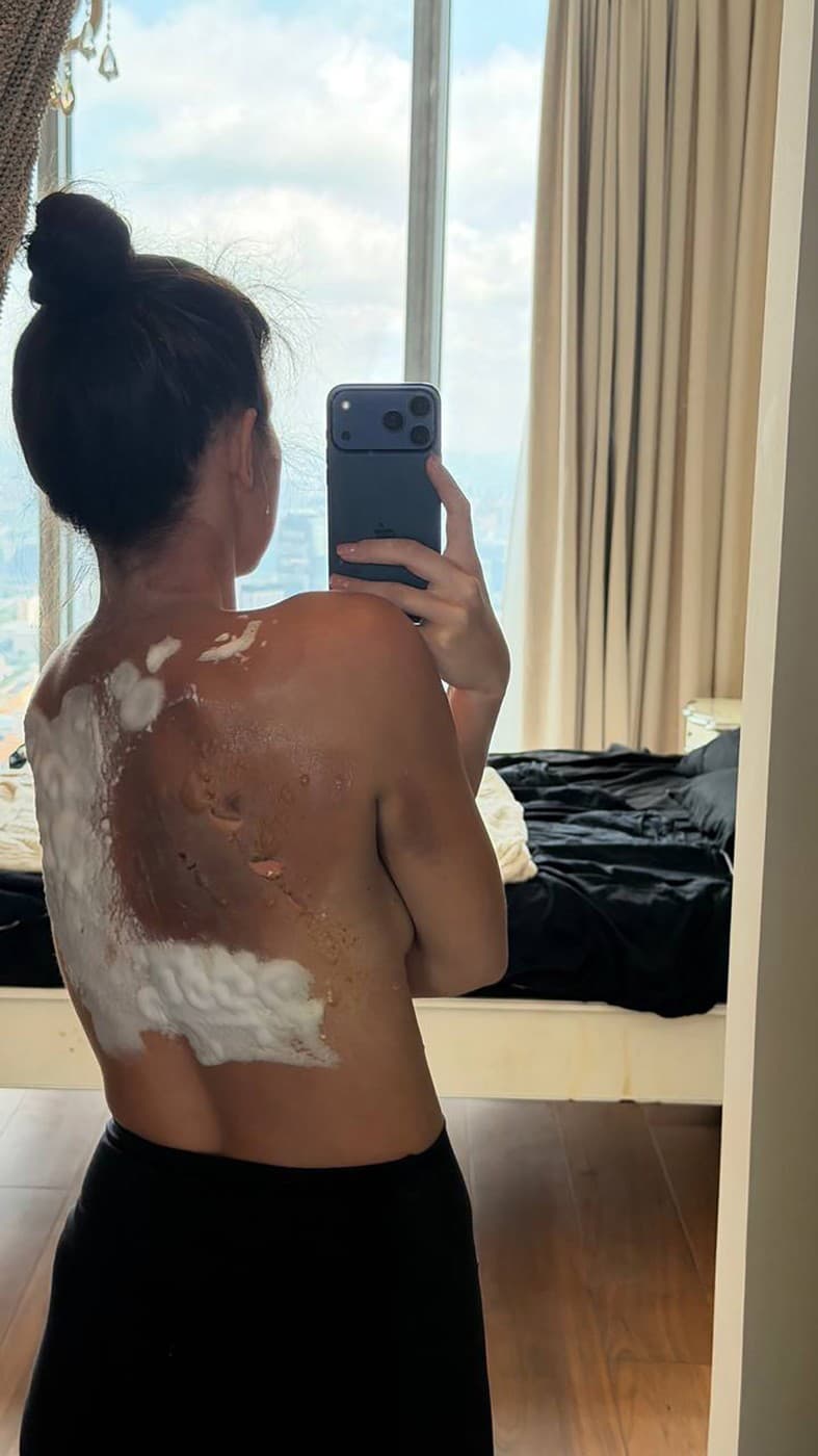Ruská influencerka Anna Otavinová (24) utiekla smrti, keď v jej moskovskom  byte začalo v noci horieť