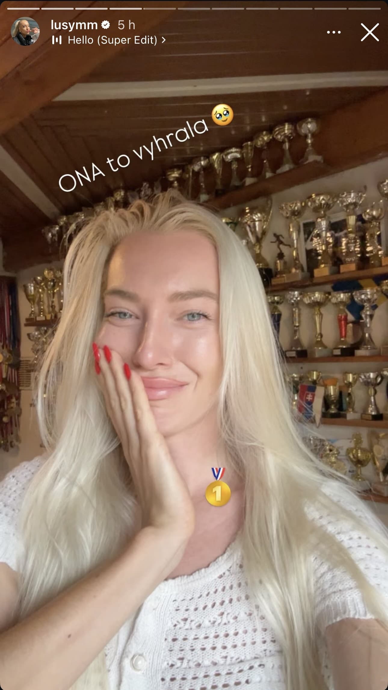 Hviezdička reality show je na svoju sestru právom hrdá.
