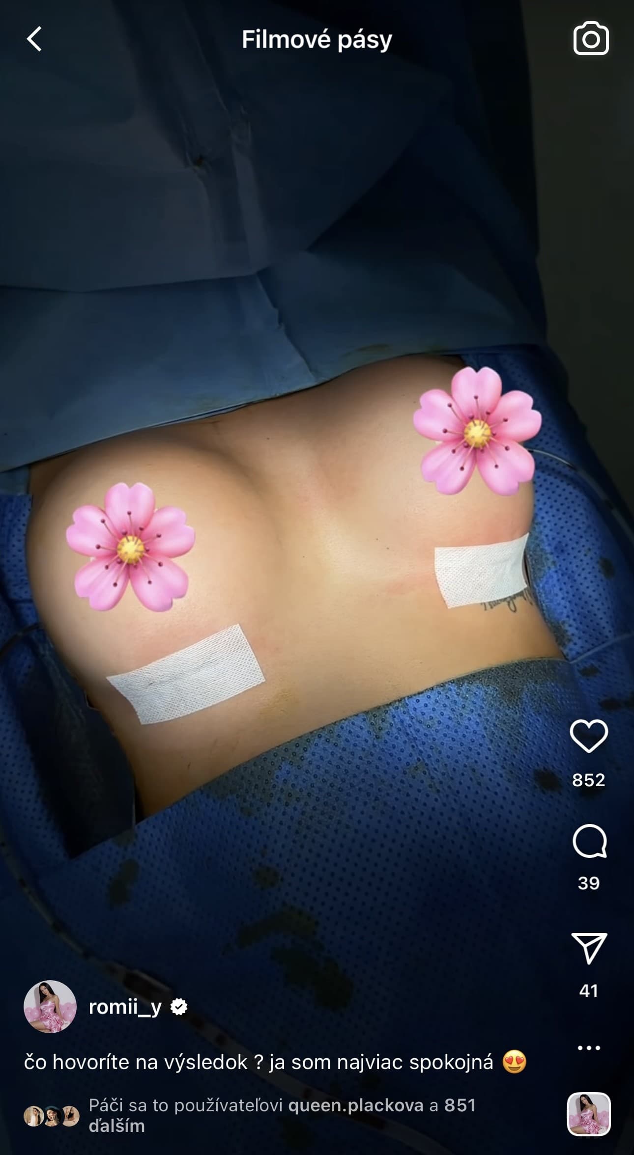 Farmárka Romana Košťálová ukázala foto pred a po plastike.