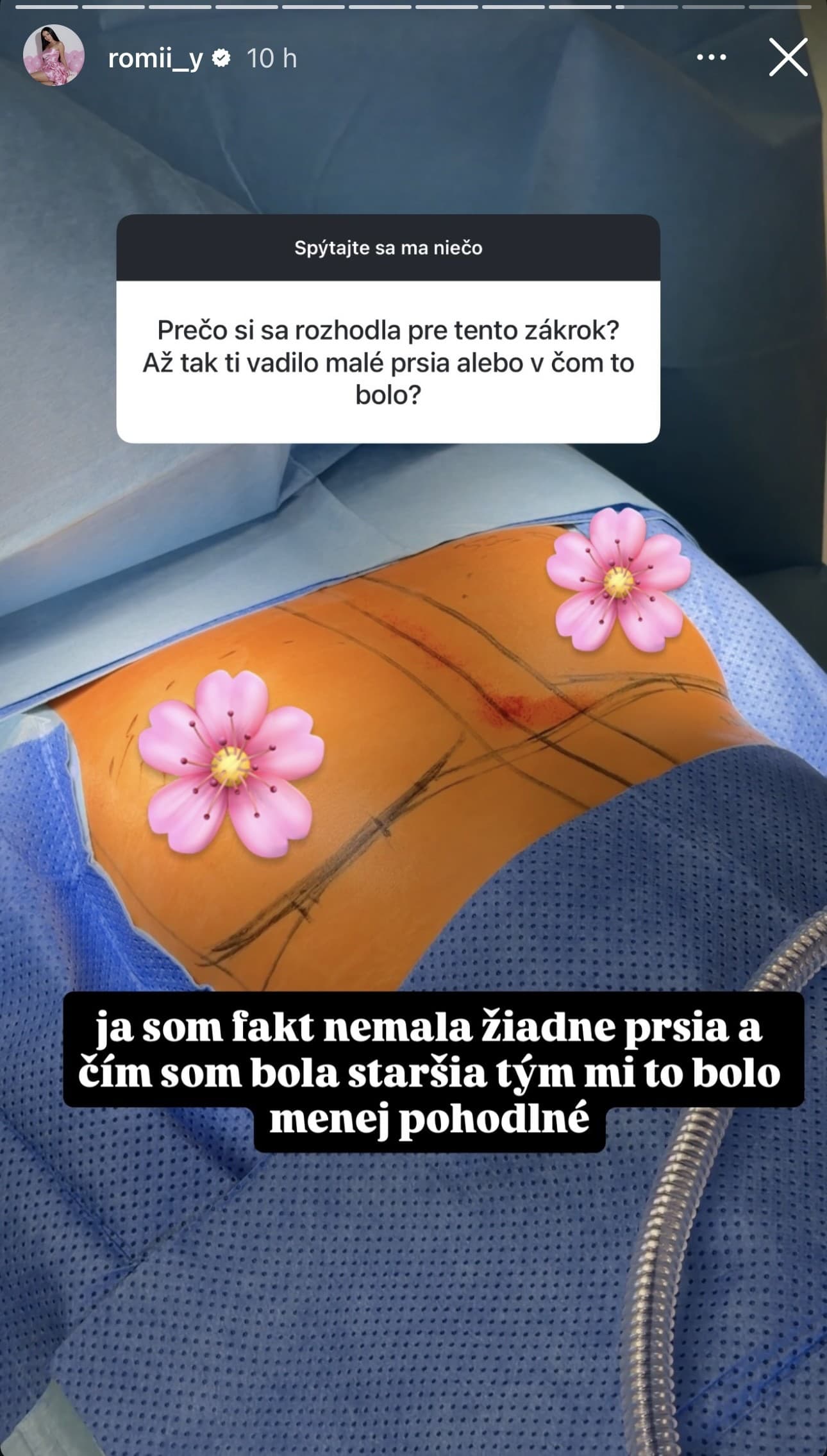 Farmárka Romana Košťálová ukázala foto pred a po plastike.