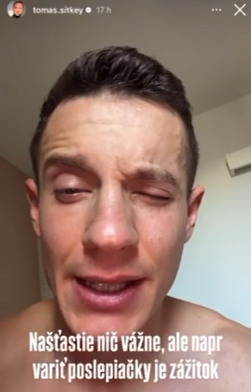 Herec Tomáš Sitkey akoby zázrakom vyviazol bez trvalých následkov.