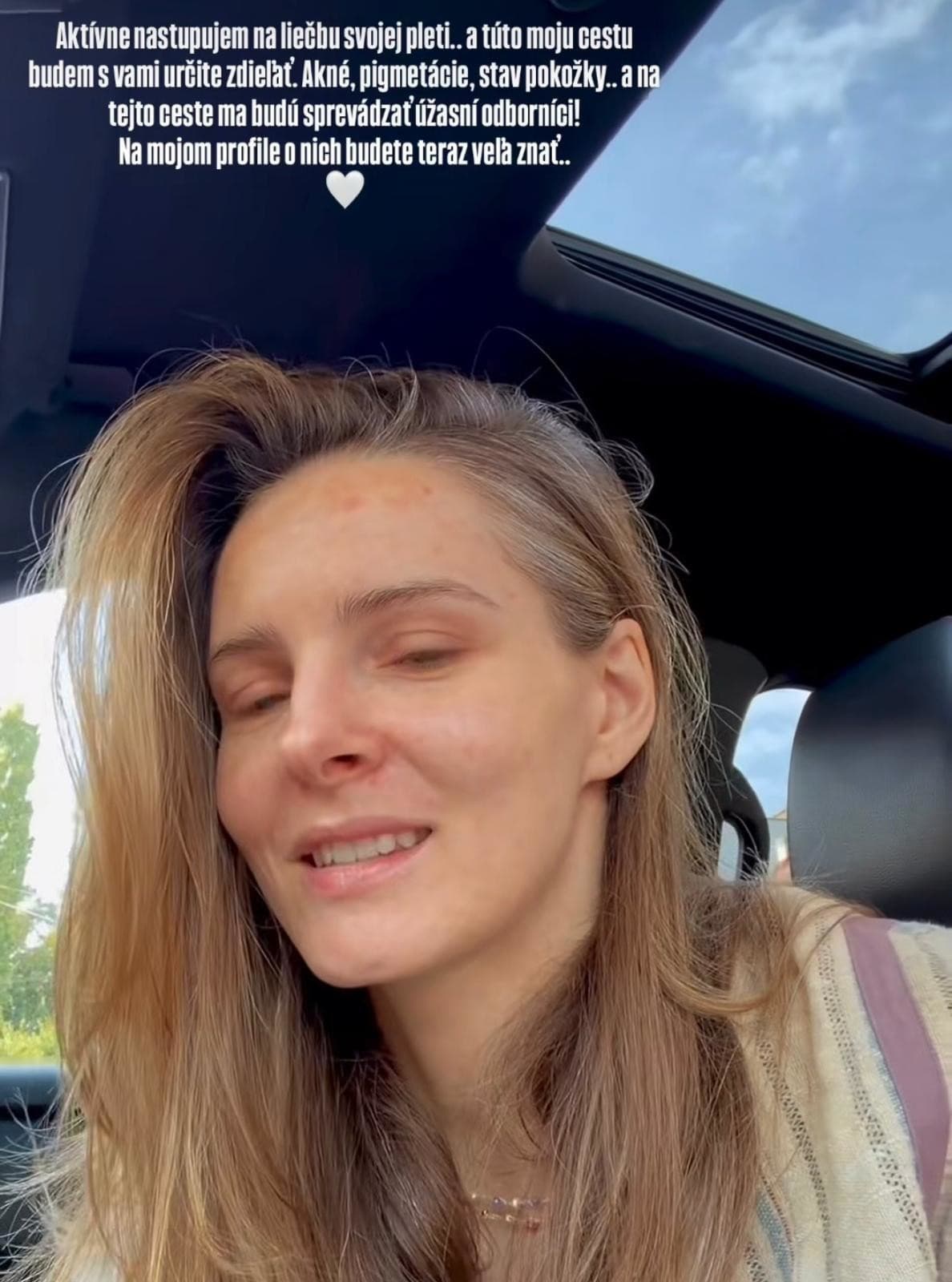 Herečka Monika Szabó nastupuje na liečbu svojej pleti. 