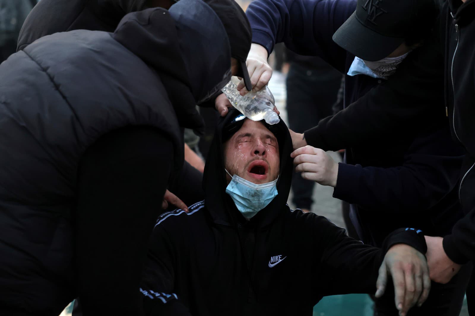 Na snímke ľudia pomáhajú demonštrantovi, ktorého zasiahol slzotvorný plyn počas protivládneho protestu v meste Tirana