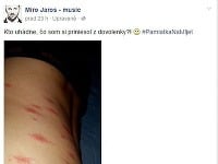Miro Jaroš sa nepríjemným suvenírom z dovolenky pochválil aj svojim fanúšikom na sociálnej sieti Facebook. 
