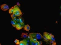 RNA in vivo detekcia v bunkách karcinómu tráviacej trubice