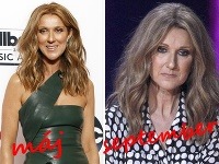 Tieto fotografie delia od seba zhruba 4 mesiace. Ako vidno, Céline Dion choroba jej manžela ničí. Tieto fotografie delia od seba zhruba 4 mesiace. Ako vidno, Céline Dion choroba jej manžela ničí.