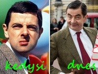 Rowan Atkinson ako Mr. Bean kedysi a dnes. 