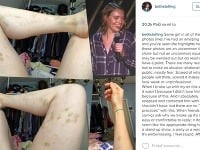 Komička Beth Stelling sa otvorene priznala k tomu, že bola obeťou domáceho násilia. 