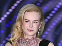 Nicole Kidman má tvár mladice a ruky stareny. 