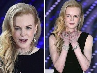 Nicole Kidman sa podarilo oklamať čas... Ale len tvárou. 