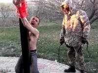 Na mladíkovej tvári vidno všetku bolesť. Na mladíkovej tvári vidno všetku bolesť.
